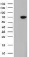 EPM2A Interacting Protein 1 antibody, LS-C115695, Lifespan Biosciences, Western Blot image 