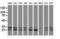 Caseinolytic Mitochondrial Matrix Peptidase Proteolytic Subunit antibody, LS-C115833, Lifespan Biosciences, Western Blot image 