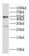 Galactosylceramidase antibody, FNab03308, FineTest, Western Blot image 