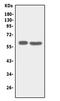 Solute carrier family 22 member 6 antibody, PA1683, Boster Biological Technology, Western Blot image 