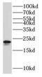 Ribosomal Protein L9 antibody, FNab07446, FineTest, Western Blot image 