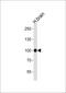 Cadherin 13 antibody, MBS9206562, MyBioSource, Western Blot image 