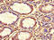 Chromosome 12 Open Reading Frame 65 antibody, LS-C677334, Lifespan Biosciences, Immunohistochemistry paraffin image 