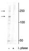 Xin actin-binding repeat-containing protein 1 antibody, P07785, Boster Biological Technology, Western Blot image 