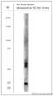 Solute Carrier Family 17 Member 7 antibody, LS-C95237, Lifespan Biosciences, Western Blot image 