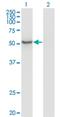 Zinc Finger Protein 70 antibody, H00007621-M01, Novus Biologicals, Western Blot image 