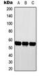 Cytochrome P450 Family 2 Subfamily D Member 6 antibody, GTX56287, GeneTex, Western Blot image 