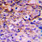 BMX Non-Receptor Tyrosine Kinase antibody, GTX56219, GeneTex, Immunohistochemistry paraffin image 