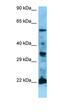Ras antibody, orb331222, Biorbyt, Western Blot image 