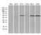 Fascin Actin-Bundling Protein 1 antibody, LS-C798389, Lifespan Biosciences, Western Blot image 