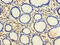 C-Type Lectin Domain Family 18 Member A antibody, CSB-PA005521LA01HU, Cusabio, Immunohistochemistry paraffin image 