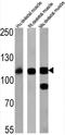 ATPase Sarcoplasmic/Endoplasmic Reticulum Ca2+ Transporting 1 antibody, NB300-622, Novus Biologicals, Western Blot image 