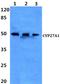 Sterol 26-hydroxylase, mitochondrial antibody, AP06773PU-N, Origene, Western Blot image 