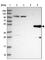 Homogentisate 1,2-Dioxygenase antibody, HPA047374, Atlas Antibodies, Western Blot image 