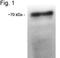 Cholesteryl Ester Transfer Protein antibody, NB300-558, Novus Biologicals, Western Blot image 