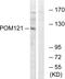 POM121 antibody, PA5-39308, Invitrogen Antibodies, Western Blot image 