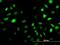 Sestrin-2 antibody, H00083667-M03, Novus Biologicals, Immunofluorescence image 