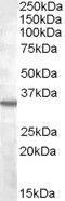 Bradykinin Receptor B1 antibody, GTX88647, GeneTex, Western Blot image 