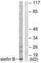 Stefin-B antibody, TA313376, Origene, Western Blot image 
