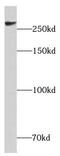 Chromodomain Helicase DNA Binding Protein 4 antibody, FNab01643, FineTest, Western Blot image 