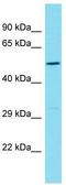 PIH1 Domain Containing 2 antibody, TA334112, Origene, Western Blot image 