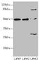 Zinc finger and BTB domain-containing protein 25 antibody, orb40625, Biorbyt, Western Blot image 