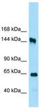 Ribosomal RNA Processing 12 Homolog antibody, TA333837, Origene, Western Blot image 