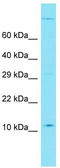 Chromosome 1 Open Reading Frame 210 antibody, TA334787, Origene, Western Blot image 