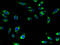 Sodium/glucose cotransporter 5 antibody, A63446-100, Epigentek, Immunofluorescence image 