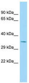 Olfactory Receptor Family 52 Subfamily A Member 1 antibody, TA334341, Origene, Western Blot image 