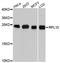 Ribosomal Protein L10 antibody, A9233, ABclonal Technology, Western Blot image 