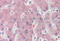 Nicotinamide N-Methyltransferase antibody, ARP42281_T100, Aviva Systems Biology, Immunohistochemistry frozen image 