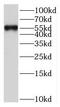 RAK antibody, FNab03224, FineTest, Western Blot image 