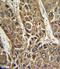 Microsomal Triglyceride Transfer Protein antibody, LS-C164672, Lifespan Biosciences, Immunohistochemistry paraffin image 