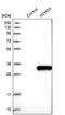 Haloacid Dehalogenase Like Hydrolase Domain Containing 3 antibody, PA5-54203, Invitrogen Antibodies, Western Blot image 
