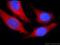 Single-Pass Membrane Protein With Coiled-Coil Domains 1 antibody, 25362-1-AP, Proteintech Group, Immunofluorescence image 