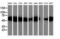 Sequestosome 1 antibody, LS-C785388, Lifespan Biosciences, Western Blot image 