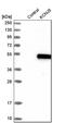 Potassium Voltage-Gated Channel Subfamily J Member 5 antibody, PA5-53594, Invitrogen Antibodies, Western Blot image 