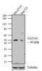 GATA Binding Protein 4 antibody, GTX54530, GeneTex, Western Blot image 