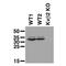 Potassium Voltage-Gated Channel Subfamily A Regulatory Beta Subunit 2 antibody, 73-021, Antibodies Incorporated, Western Blot image 