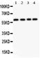 Cbfa1 antibody, LS-C344017, Lifespan Biosciences, Western Blot image 