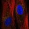 Angiopoietin Like 2 antibody, HPA041299, Atlas Antibodies, Immunofluorescence image 