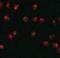 Zinc Finger Protein 281 antibody, NBP1-76551, Novus Biologicals, Immunocytochemistry image 