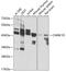 Calcium/Calmodulin Dependent Protein Kinase ID antibody, 22-996, ProSci, Western Blot image 