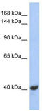 Potassium voltage-gated channel subfamily KQT member 2 antibody, TA338752, Origene, Western Blot image 