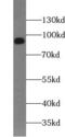 Segment polarity protein dishevelled homolog DVL-2 antibody, FNab02573, FineTest, Western Blot image 
