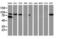 Catenin Beta 1 antibody, LS-C172637, Lifespan Biosciences, Western Blot image 