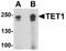 Tet Methylcytosine Dioxygenase 1 antibody, A00603, Boster Biological Technology, Western Blot image 