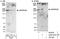 Ankyrin Repeat Domain 26 antibody, A302-307A, Bethyl Labs, Immunoprecipitation image 