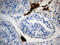 Mitochondria Localized Glutamic Acid Rich Protein antibody, M09345, Boster Biological Technology, Immunohistochemistry paraffin image 